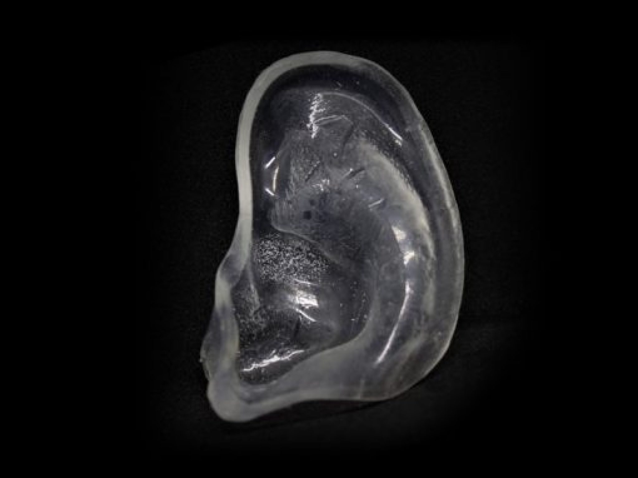 Mother of Rugby Player Invented Her Own Cauliflower Ears Protection