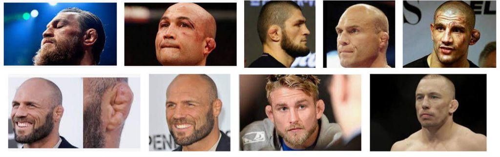 UFC fighters ears look weird