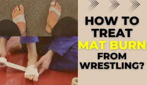 How to treat mat burn from wrestling